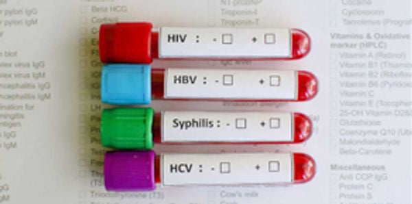 Sexually Transmitted Infection (STI) Testing